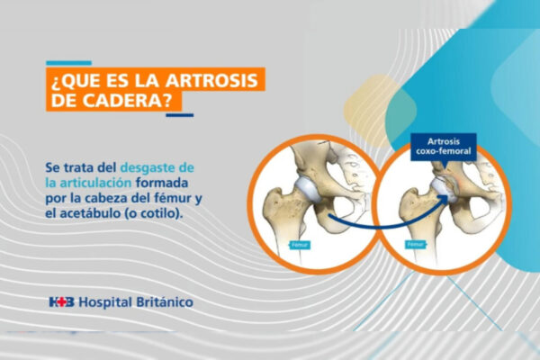 InShot 20230509 181259342 - Patologías frecuentes